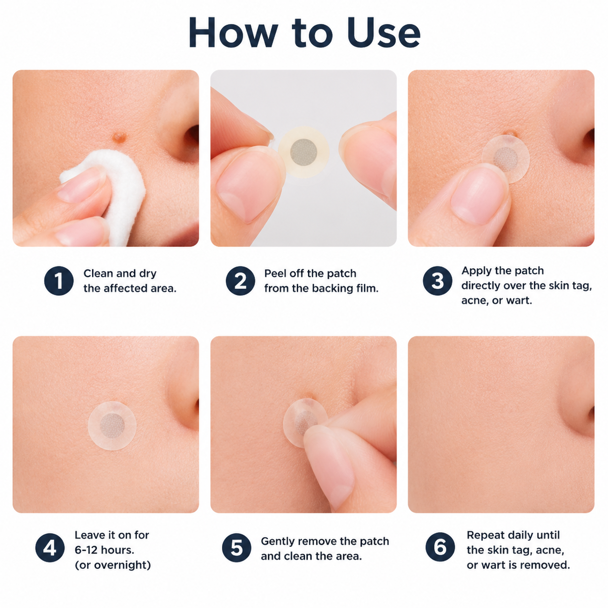 ✨Virellora®2-in-1 Microneedle & Hydrocolloid Patch
