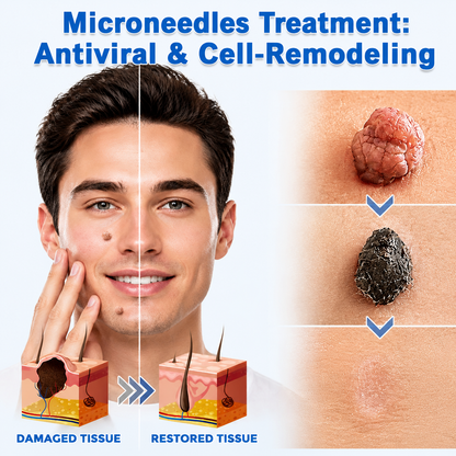 ✨Virellora®2-in-1 Microneedle & Hydrocolloid Patch