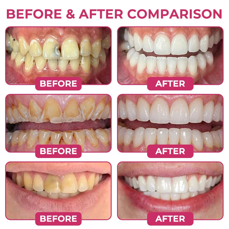 COUGEX® Cavity-Repair Natural Enamel Filling Gel